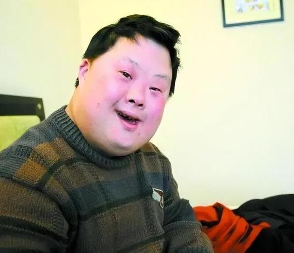 亭亭玉立国色天香综合症