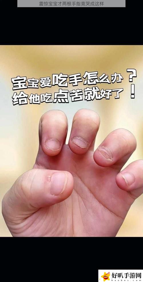 宝宝两根手指为何会疼哭